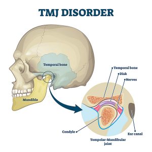 Temporomandibular joint (TMJ)