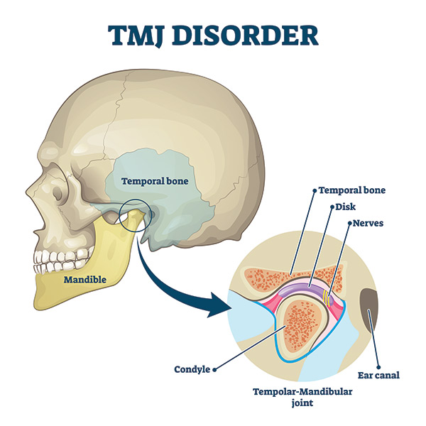 Temporomandibular joint (TMJ)